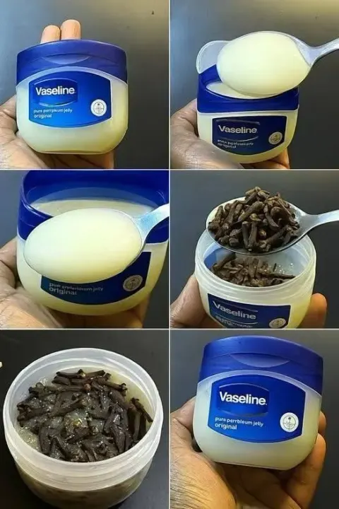 The Clove & Petroleum Jelly Salve: Nature’s Simple, Potent Secret